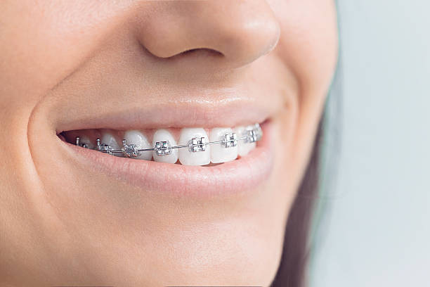Best Full Mouth Reconstruction  in Sandy, OR
